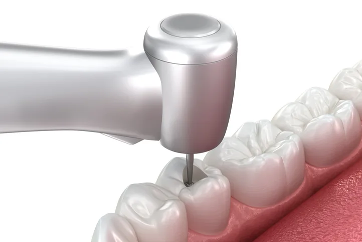 Post endodoncia 2